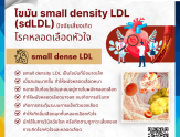 ไขมัน small density LDL (sdLDL) ปัจจัยเสี่ยงเกิดโรคหลอดเลือดหัวใจ