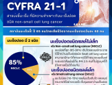 Cyfra 21-1 สารบ่งชี้มะเร็งที่มีความจำเพาะกับมะเร็งปอดชนิด non-small cell lung cancer